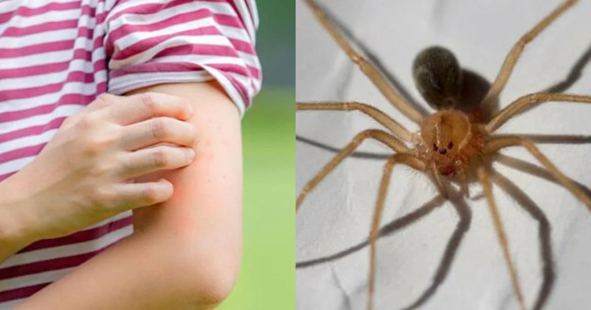 Alerta por mordedura de araña casera: un problema de salud pública que ha incrementado en Lima, San Martín y Arequipa
