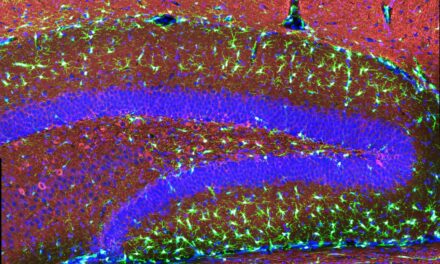 Cómo una mutación en la microglía eleva el riesgo de Alzheimer |  Noticias del MIT