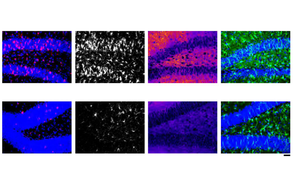 El ARN administrado con nanopartículas reduce la neuroinflamación en pruebas de laboratorio |  Noticias del MIT