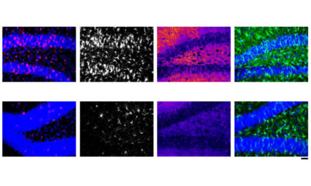 El ARN administrado con nanopartículas reduce la neuroinflamación en pruebas de laboratorio |  Noticias del MIT