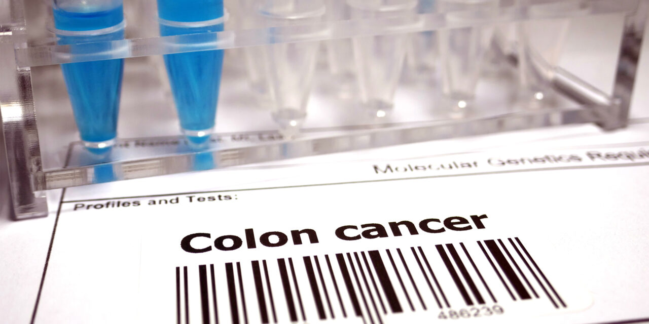 Estudio: Las pruebas de detección del cáncer de colon son más efectivas de lo que se pensaba anteriormente |  Noticias del MIT