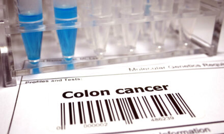 Estudio: Las pruebas de detección del cáncer de colon son más efectivas de lo que se pensaba anteriormente |  Noticias del MIT