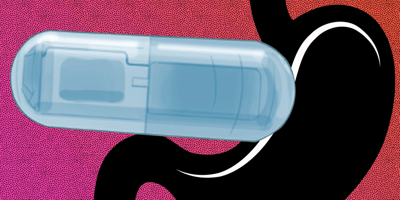 Ingenieros desarrollan una cápsula vibratoria ingerible que podría ayudar a tratar la obesidad |  Noticias del MIT