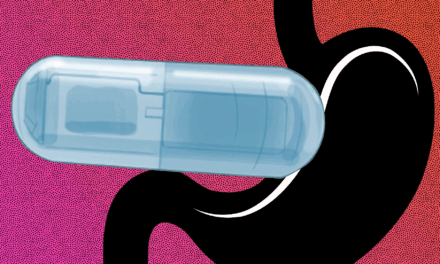 Ingenieros desarrollan una cápsula vibratoria ingerible que podría ayudar a tratar la obesidad |  Noticias del MIT