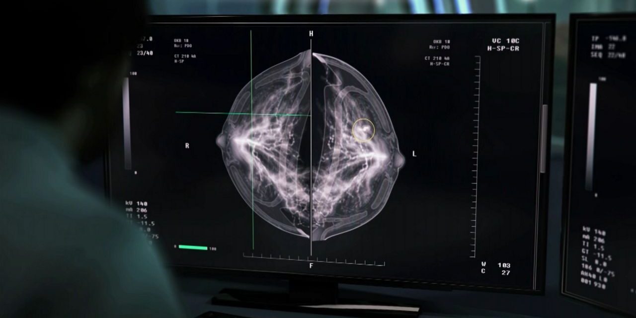 Proyecto de ley de Nueva York ampliaría la cobertura de exámenes de detección de cáncer de mama