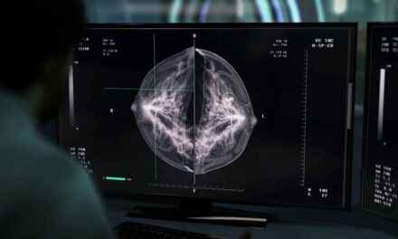 Proyecto de ley de Nueva York ampliaría la cobertura de exámenes de detección de cáncer de mama